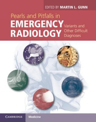 Carte Pearls and Pitfalls in Emergency Radiology Martin L Gunn