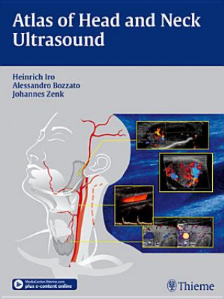 Könyv Atlas of Head and Neck Ultrasound Heinrich Iro