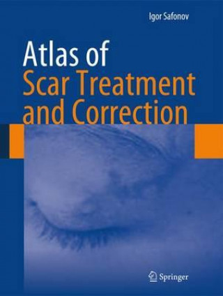 Kniha Atlas of Scar Treatment and Correction Safonov