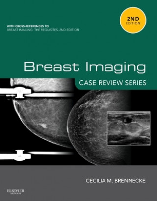 Książka Breast Imaging: Case Review Series Cecilia Brennecke