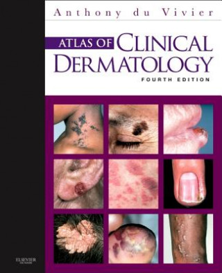 Książka Atlas of Clinical Dermatology Anthony Du Vivier