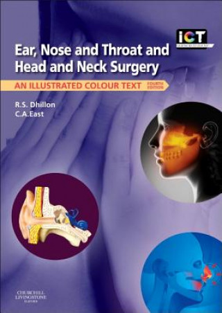 Carte Ear, Nose and Throat and Head and Neck Surgery R S Dhillon