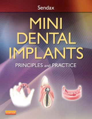 Carte Mini Dental Implants Dr Victor Sendax