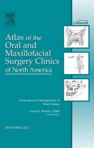 Kniha Contemporary Management of Third Molars, An Issue of Atlas of the Oral and Maxillofacial Surgery Clinics Louis K Rafetto