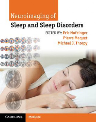 Книга Neuroimaging of Sleep and Sleep Disorders Eric Nofzinger