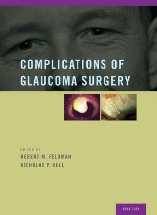 Könyv Complications of Glaucoma Surgery Robert M Feldman