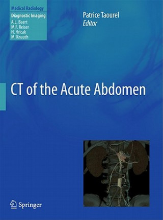 Kniha CT of the Acute Abdomen Patrice Taourel