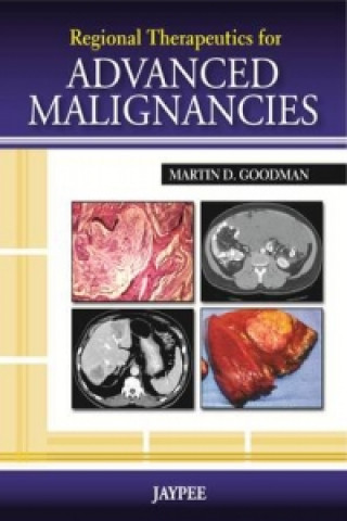 Kniha Regional Therapeutics for Advanced Malignancies Martin D Goodman