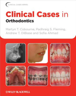 Kniha Clinical Cases in Orthodontics Martyn T Cobourne