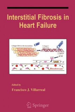 Carte Interstitial Fibrosis in Heart Failure Francisco Villarreal