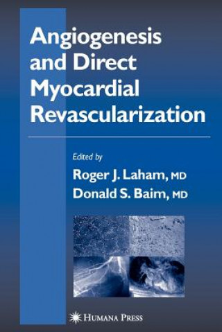 Kniha Angiogenesis and Direct Myocardial Revascularization Roger J Laham