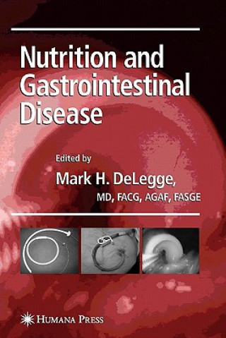 Книга Nutrition and Gastrointestinal Disease Mark DeLegge
