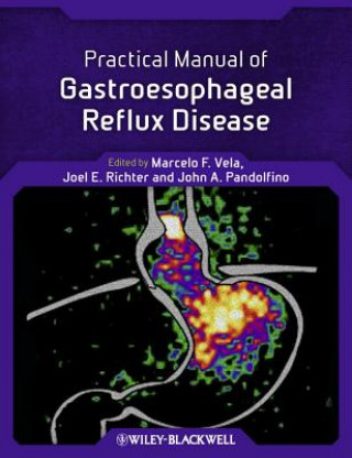 Könyv Practical Manual of Gastroesophageal Reflux Disease Marcelo F Vela