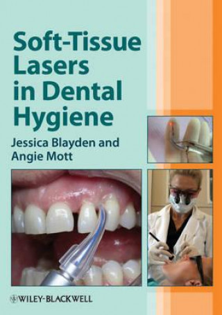 Kniha Soft-Tissue Lasers in Dental Hygiene Jessica Blayden