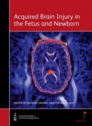 Carte Acquired Brain Injury in the Fetus and Newborn Michael Shevell