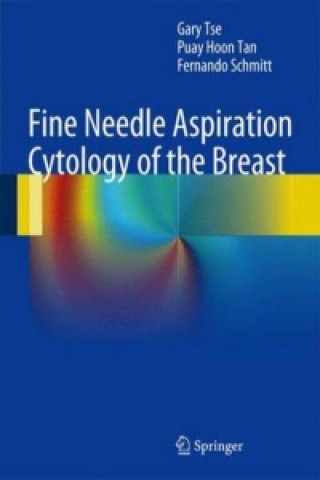 Carte Fine Needle Aspiration Cytology of the Breast Gary Tse