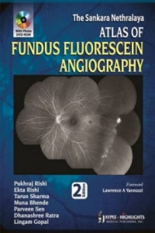 Könyv Atlas of Fundus Fluorescein Angiography Pukhraj Rishi