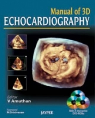 Libro Manual of 3D Echocardiography V Amuthan