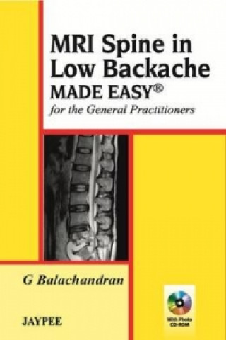 Carte MRI Spine in Low Backache Made Easy G Balachandran