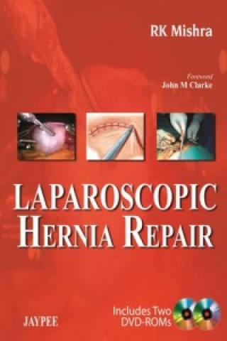 Carte Laparoscopic Hernia Repair RK Mishra