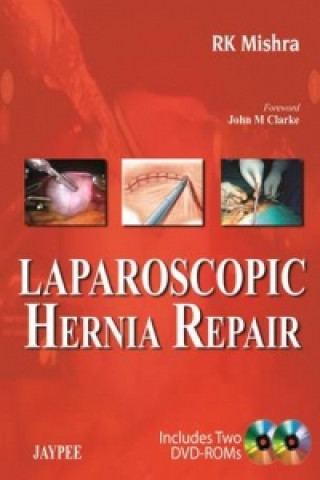 Book Laparoscopic Hernia Repair RK Mishra