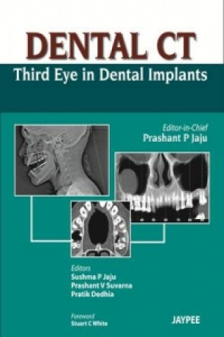 Könyv Dental CT Third Eye in Dental Implants Prashant P Jaju