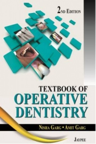 Kniha Textbook of Operative Dentistry Nisha Garg