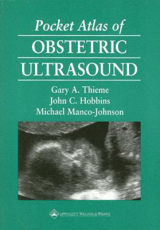 Carte Pocket Atlas of Obstetric Ultrasound G A Thieme