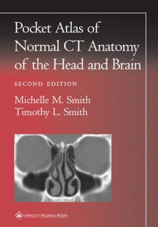 Kniha Pocket Atlas of Normal CT Anatomy of the Head and Brain Anton N Hasso
