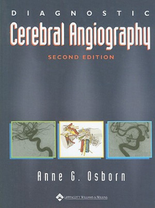 Könyv Diagnostic Cerebral Angiography Anne G Osborn