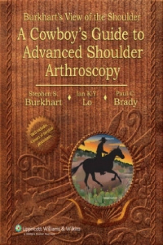 Kniha Burkhart's View of the Shoulder Stephen S Burkhart