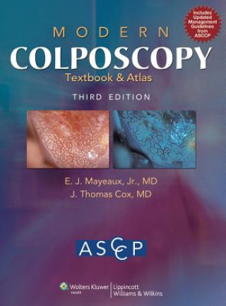 Carte Modern Colposcopy Textbook and Atlas American Society For Colposcopy & Cerv