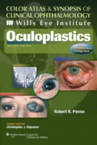 Kniha Wills Eye Institute - Oculoplastics Robert B Penne