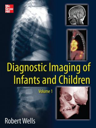 Knjiga Diagnostic Imaging of Infants and Children Robert Wells