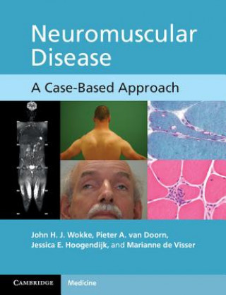 Kniha Neuromuscular Disease John HJ Wokke