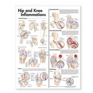 Könyv Hip and Knee Inflammations Anatomical Chart Anatomical Chart Company