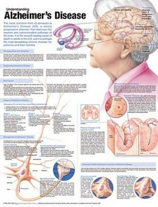 Kniha Understanding Alzheimer's Disease Anatomical Chart Anatomical Chart Company