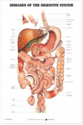 Könyv Diseases of the Digestive System Anatomical Chart Anatomical Chart Company