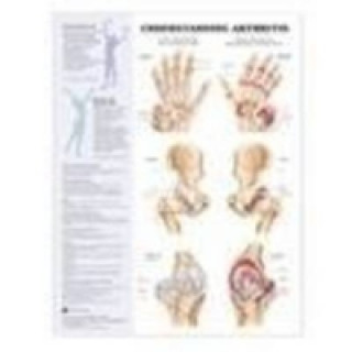 Книга Understanding Arthritis Anatomical Chart Anatomical Chart Company