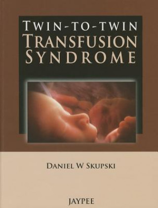 Knjiga Twin-to-Twin Transfusion Syndrome Daniel W Skupski