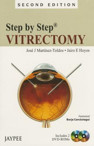Książka Step by Step: Vitrectomy Jose J Martinez Toldos