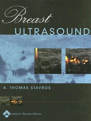 Könyv Breast Ultrasound A.Thomas Stavros