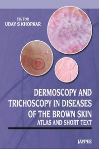 Könyv Dermoscopy and Trichoscopy in Diseases of the Brown Skin Uday S Khopkar