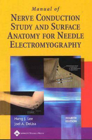Könyv Manual of Nerve Conduction Study and Surface Anatomy for Needle Electromyography Joel A DeLisa