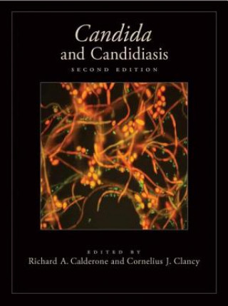 Carte Candida and Candidiasis Richard A Calderone