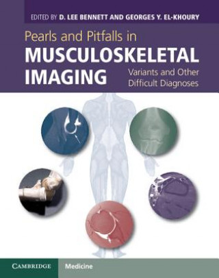 Książka Pearls and Pitfalls in Musculoskeletal Imaging D Lee Bennett