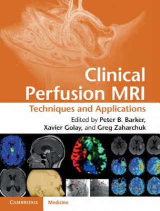 Knjiga Clinical Perfusion MRI Peter Barker