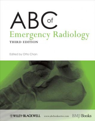 Könyv ABC of Emergency Radiology 3e Otto Chan