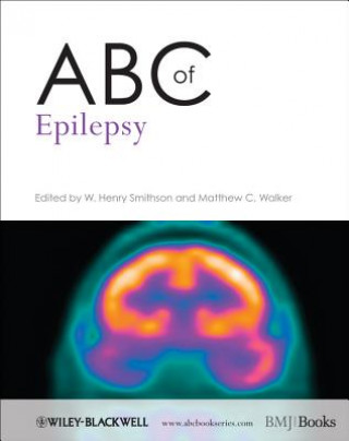 Könyv ABC of Epilepsy W Henry Smithson