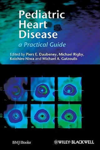 Könyv Pediatric Heart Disease - A Practical Guide Peirs Daubeney